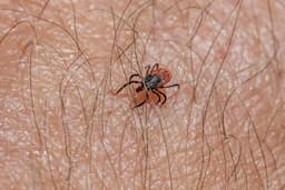 Alerta de rickettsiosis: Al alza en el estado