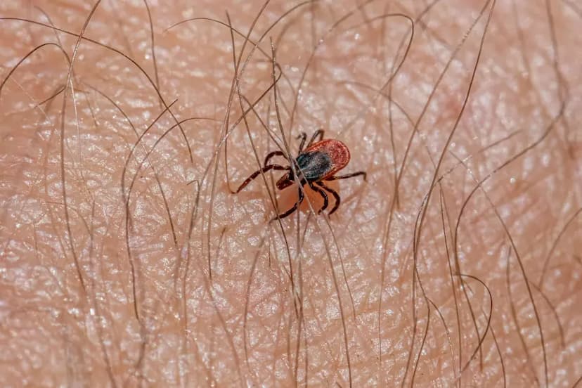 Alerta de rickettsiosis: Al alza en el estado